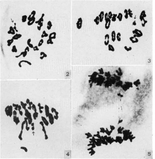 FIGURE  S.-First  meiotic  anaphase  showing  the  double  dicentric  bridge.  The  knobs  near  the  center  presumably  represent  the  minute  arm  beyond  the  secondary  centromere