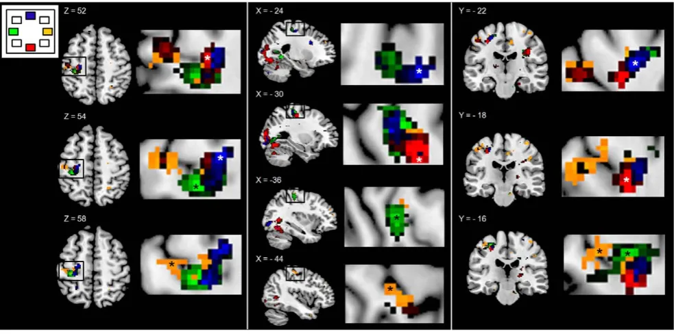 Figure 3. Direction-related activation patterns in the primary motor area. Activation patterns in the primary motor area (M1) along theshown at the left side of each slice