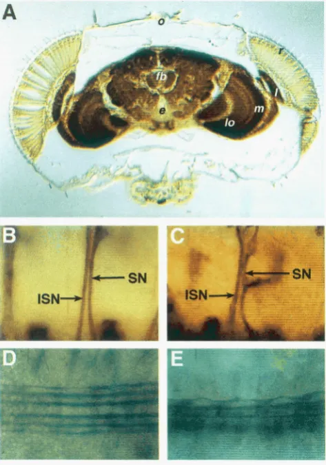FIGURE 5.-Absence  of the mature embryonic  nervous system. 