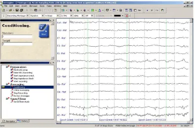 Figure 2.9: EEG on referential montage using Advanced Source Analysis (ASA). 
