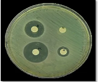 Figure 11: Agar inhibition test for S.mutans   