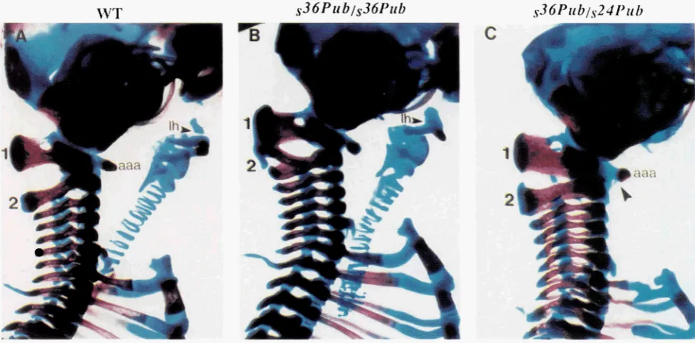 FIGURE S.-Skeletal  defects split showing arches  and a characteristic  anterior  arch of the  atlas horn