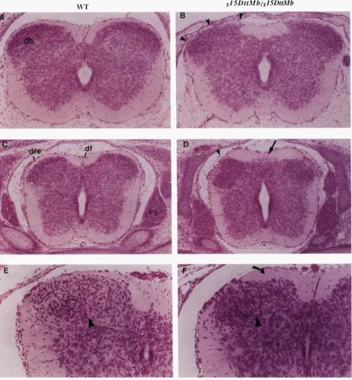 FIGURE 4.-Organization Transverse  section through the cervical  spinal cord of a normal littermate and a surrounding white matter (funicular zone)