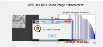 Figure 5shows the DWT with SVD .After taking  Discrete wavelet transform, applying SVD process to the imageit is possible to find the best approximation of the original data points using fewer dimensions