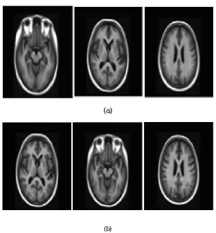 Fig. 2. Average MRI images from groupwise registration of all subjects in comparing the average obtained via (a) MRI-based  and (b) multistructure registration