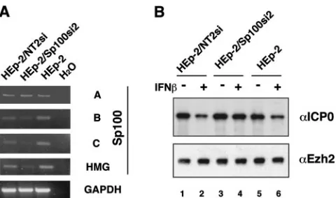 FIG. 7. Effect of depletion of Sp100 isoforms containing SANDon(A) Knockdown of Sp100 mRNA