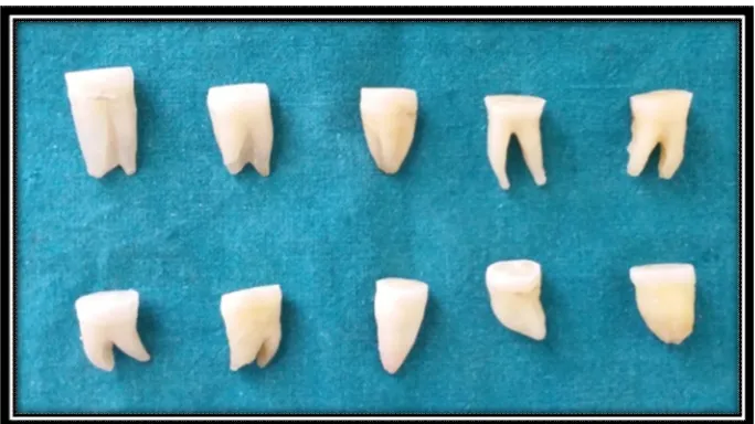 FIGURE 12- Flat mid coronal dentin surface prepared 