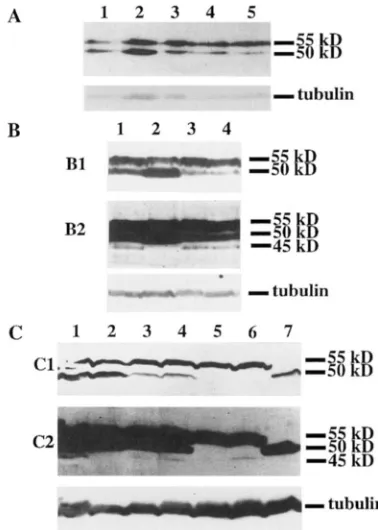 FIGURE 5.-Expression  of munohlot analysis of head 