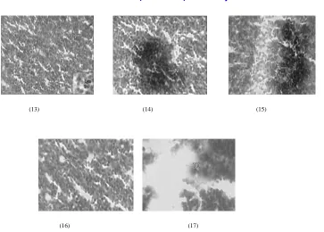 Fig.13 Microphotograph of Thymus tissue of  A. morar from control showing Lymphocytes (Lym) and Thymocytes (Th) 