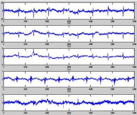 Figure 6. Comparing the efficiency of the algorithm in FECG signal extraction in 21st week of pregnancy; (a) the signal resulted from the algorithm, (b) the signal resulted from ANFIS based algorithm, (c) the signal resulted from ICA based algorithm, (d) t