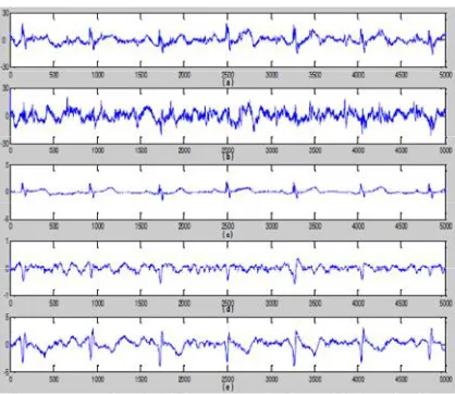 Figure 7. Comparing the efficiency of the algorithm with other algorithms in FECG signal extraction in 40th week of  pregnancy; (a) the signal resulted from the algorithm, (b) the signal resulted from ANFIS based algorithm, (c) the signal resulted from ICA