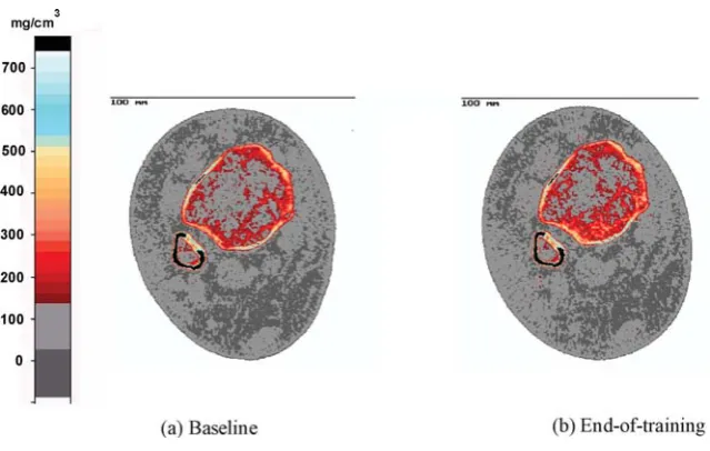 Table 3. Bone and muscle cross-sectional area data estimated from pQCT scans.