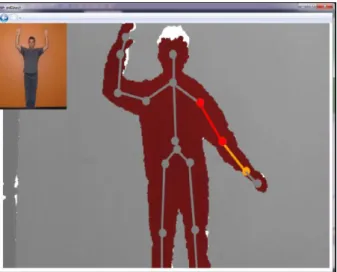 Figure 5: Errors in the Bone Orientation with respect to the Parent