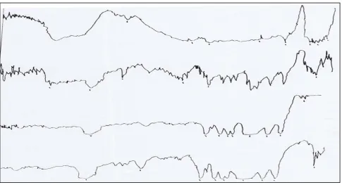 Fig. 1: Composition dependence of (PEO+KHCO3) polymer electrolyte system at different temperatures 