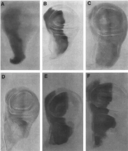 FIGURE 7.-ci which have the most severe defects. In but  a4jacent correlates with the severity compartment is not  seen