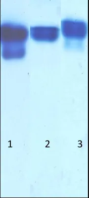 Fig. 3 Non-denaturing polyacrylamide gel electrophoresis using 15% acrylamide gel and glycine buffer, pH 4.3