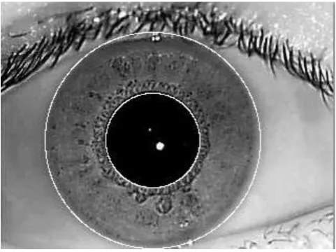 Fig. 5 Accurate detection and elimination of the eyelids and eyelashes  
