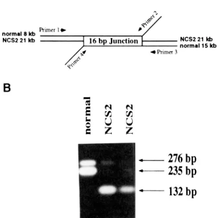 FIGURE 3.-Detection transcription PCR. 