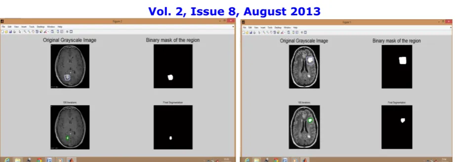 Figure 7 shows the process of training the neural network. To train the network we have selected two hidden layers and 29 iterations
