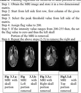 Table 6: Tracking Algorithm for Removal of skull portions of MRI Step 1: Obtain the MRI image and store it in a two dimensional 