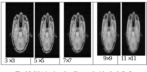 Fig 4.2: Weighted median filter applied for 3 ×3, 5 ×5, 7   ×7, 9 ×9, 11 ×11 windows of MRI 