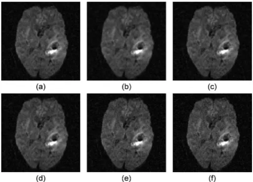 Figure 8. Representative reconstructed high-resolution fluid attenuated inversion recov-ery images