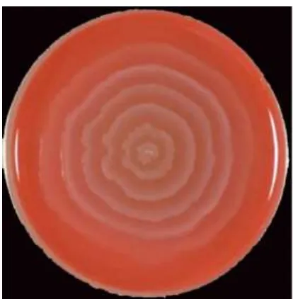 Figure 9: Blood Agar Plate  -  Swarming growth of Proteus  