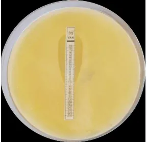 Figure 11:  Antibiotic  Sensitivity of Staphylococcus  aureus  by disc  diffusion  method 