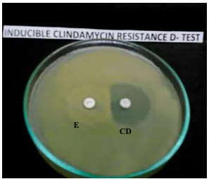Figure 13:  Antibiotic susceptibility of S.aureus  resistant to Cefoxitin (MRSA)  