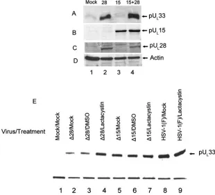 FIG. 6. Immunoblots of CV33 cells treated with proteosome inhibitors. CV33 cells (CV1 cells engineered to express pUthe indicated compounds, at which time cell lysates were prepared and separated by SDS-polyacrylamide gel electrophoresis