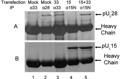 FIG. 8. Immunoblots of proteins immunoprecipitated from a28-expressing cell line (CV28)