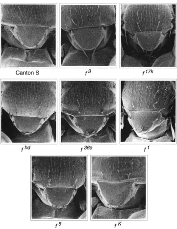 FIGURE 5,"Bristle  phenotypes forked f Canton crographs  showing  dorsal  thorax the  flies  ranges  from  the  mildf'  mu- tant of mutants