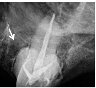 Fig. 11. Post space preparation radiographs of tooth # 11, 12, 13, 21, 24 and 26   