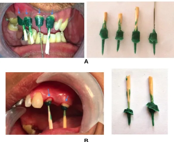 Fig. 13. Casted patterns   