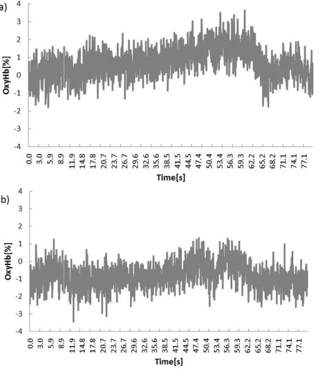 Fig. 4. Standardized variations of the local cerebral blood flow. Typical graph of time series of Standardized variations of the local cerebral blood flow