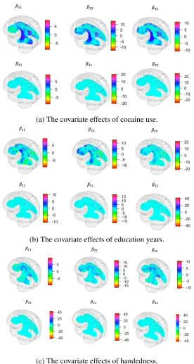 Figure 2.5:The covariate effects of social attributes on DT expressing by the posterior z-scoresof six spatially-varying coefﬁcients.