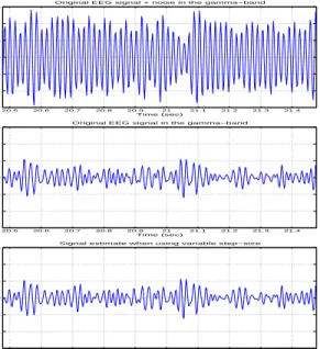 Figure 11: Gamma-band signals: (Top) Signal plus interference, (Center) Original EEG signal s(n), (Bottom) Estimated signal ˆ s(n) using the variable step-size parameter algorithm.