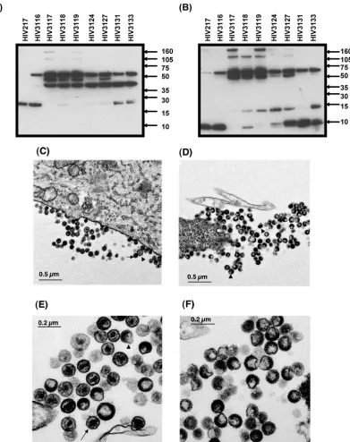 FIG. 4. Western blot and EM pictures of a series of defective HIV mutants. RD cells were transfected with a series of plasmids encodingnonviable viruses (Fig