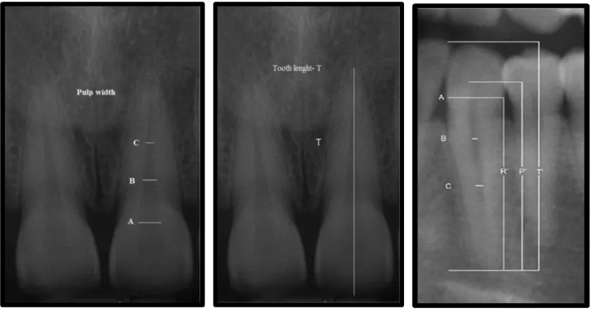 Fig. 4. Total length  