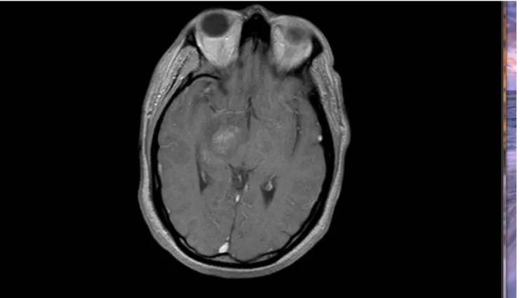 Fig. 1. Initial MRI 