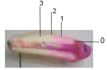 Fig. 1). The microleakage was analyzed in the cervical third, the middle third and the apical third of each root