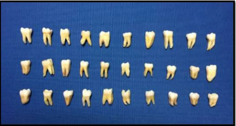Fig. 5: Sample of 30 molar teeth 
