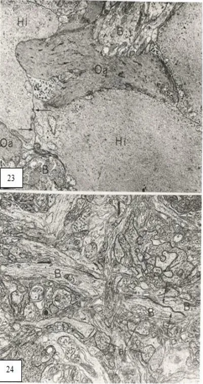 Fig. 23. Undulated amacrine cell [Oa] 