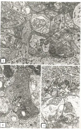 Fig. 2. Ascendant digital like process from external horizontal cell [He] branching under cone foot in the outer plexiform layer; bipolar cell dendrite [B], glycogen granules [g] in cytoplasm of external horizontal cell; Radial section, X 20400 