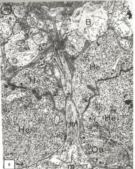 Fig.  6. External horizontal cell [He] with fused dense membranes in lateral contacts and  abundant glycogen granules,  bipolar cell [B], undulated amacrine cell [Oa], digital expansion of medium horizontal cell [Hm]  to the outer plexiform layer going to 