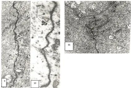 Fig. 9.  Functional contacts between medium horizontal cells [Hm] with fused dense 