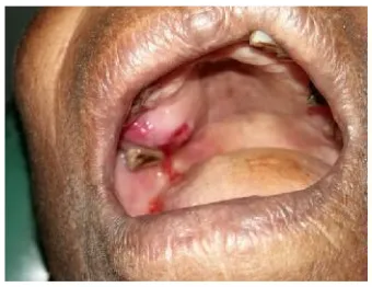 Fig. 2. Panaromic radiograph showing ill