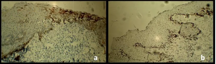 Fig. 3. H & E stained section (a) under 10x showing numerous polygonal cells and fibrousFig