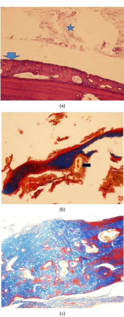 Table 1. In each of the controls filler was abundant but neither noted between the regular native bone on the right side, where the compact bone is localized in the periphery (red), 