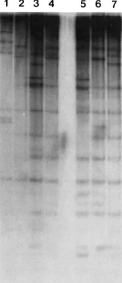 FIGURE 7.-Hybridization EcoRldigested DNA respectively, for comparison. Lane Lanes Lanes pattern  detected by pRS20.7 in of flax varieties and L